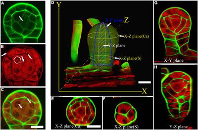 Documenting the Sporangium Development of the Polypodiales Fern Pteris multifida